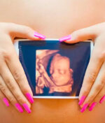 Ultrassom Morfológico: Mais que um exame, um olhar completo sobre a saúde do bebê